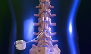 Spinal-Cord-300x178-1.png