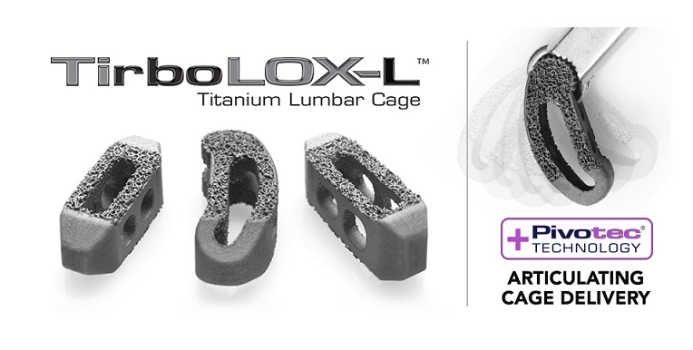 tirbolox-l-tlif-plif-cage-3d-printed-implant-captiva-spine-pr-12bto-1.jpg