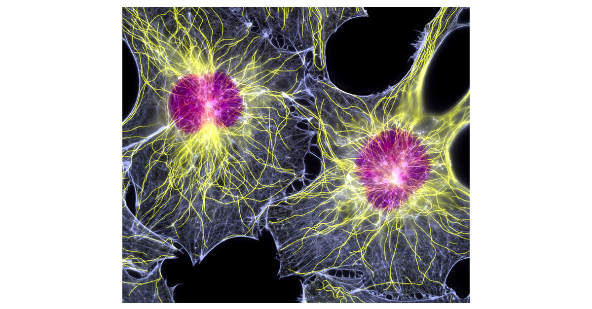 Fibroblast_cells_by_Dr._Torsten_Wittmann-1-1200x627.jpg