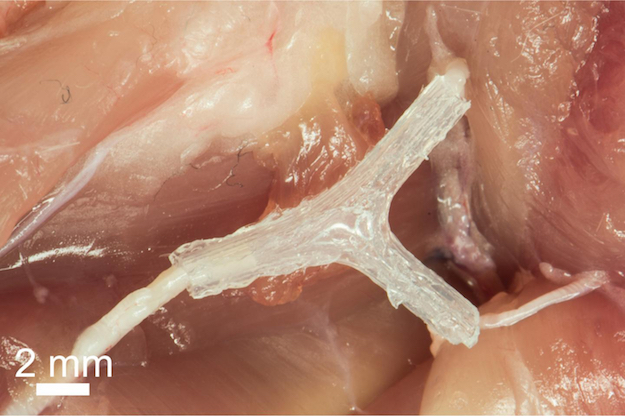 nerve-regeneration-device-625.jpg