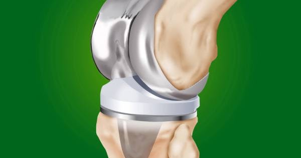 Osteosynthesis-Devices-Market-1.jpg