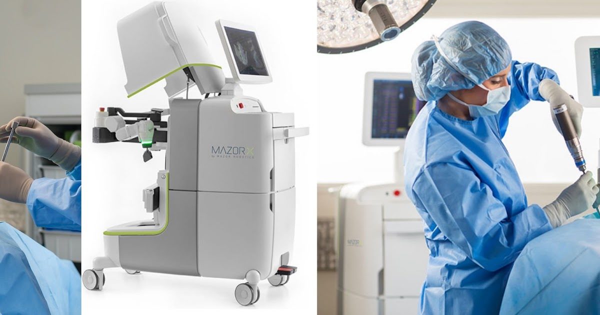 MAZOR-X-system-1200x630.jpg