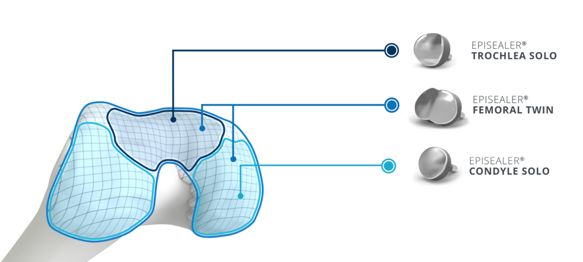 Placement-Grid1-1200x539.png