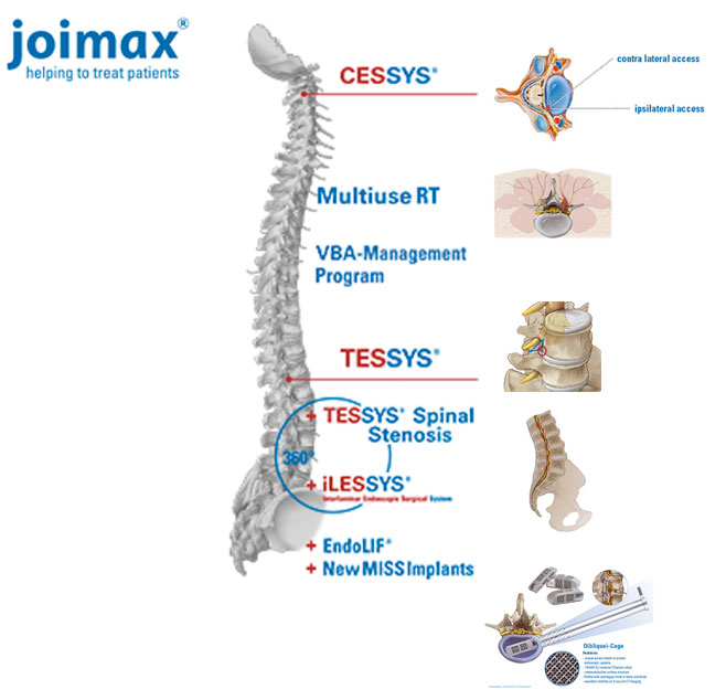 joimax.jpg