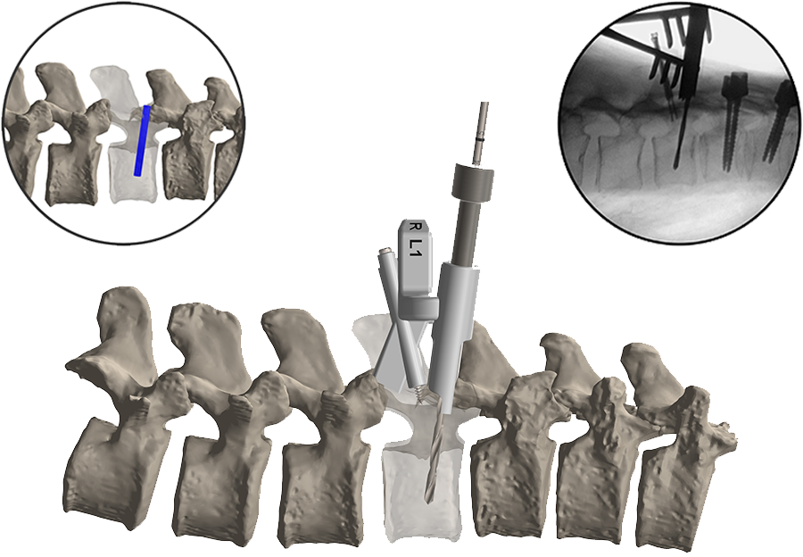 spine-image.png