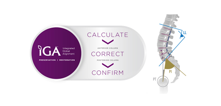 NuVasive_CervicalAlignment_WEB.jpg
