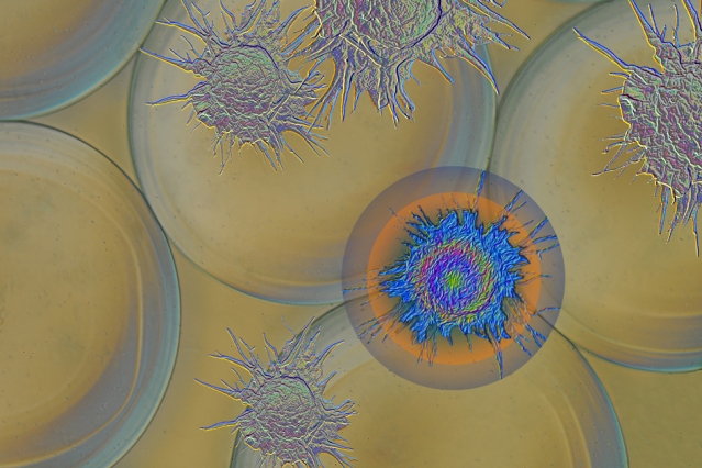 MIT-Prevent-Fibrosis_0-1.jpg