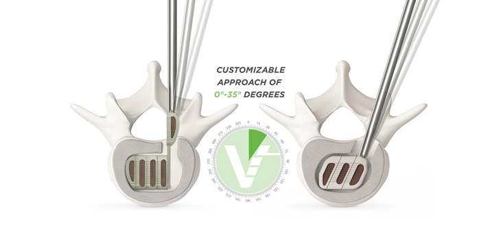 VTI_InterFuse_WEB-1.jpg