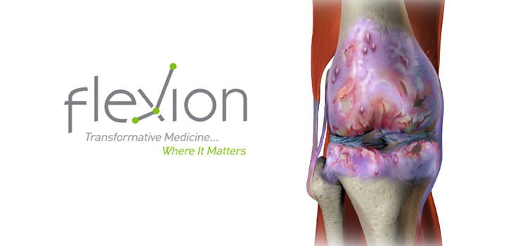 Flexion_FlexionLogoOsteoarthritisKnee_WEB-2.jpg