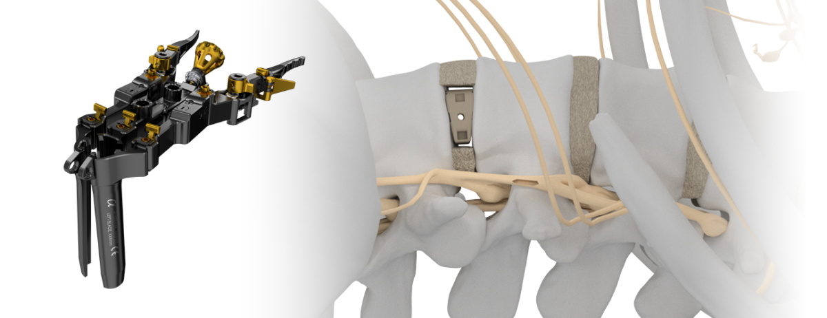 Squadron-retractor-and-Battalion-Lateral-implant-Slider-Image5-1-1200x462.png