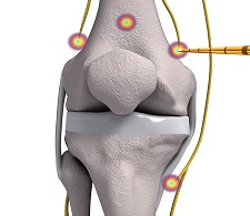 knee-bluebox-1.jpg