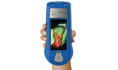 moleculight-2.jpg