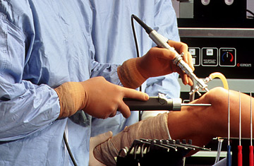 360_arthroscopy_0910-1.jpg