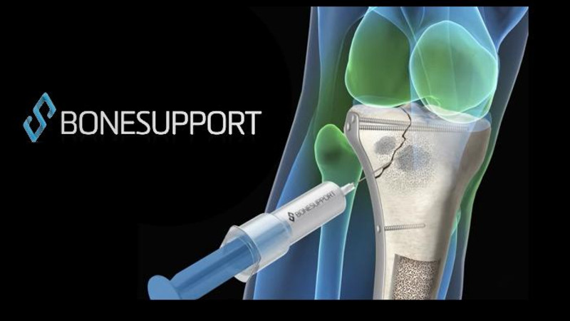 csm_Bonesupport_c3a3f2780c.jpg
