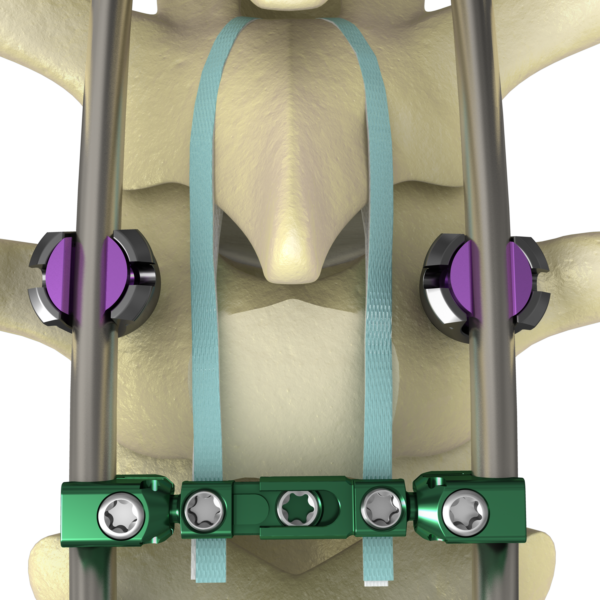 NILE_Prox_ST_IMG_02-e1499344743694.png