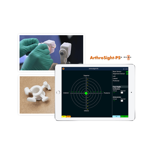 arthrosight_home-1.png