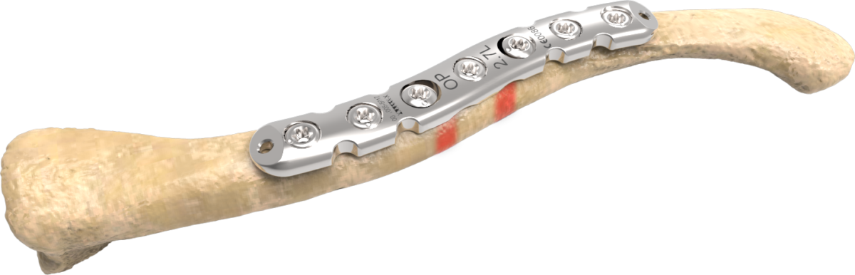 7-hole-plate-with-markings-1-1200x386.png