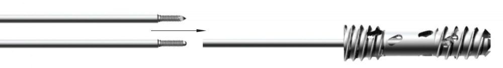 Scaltoff_Stackable_Guide_Wire-e1503441242870-1.jpg