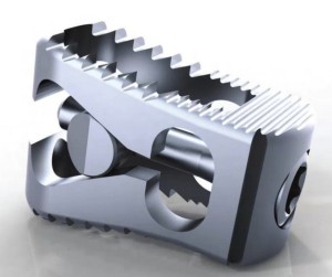 SpineSource_Launches_Expandable_Lumbar_Interbody_Cage_In_U_S____OrthoSpineNews-300x251-1.jpg