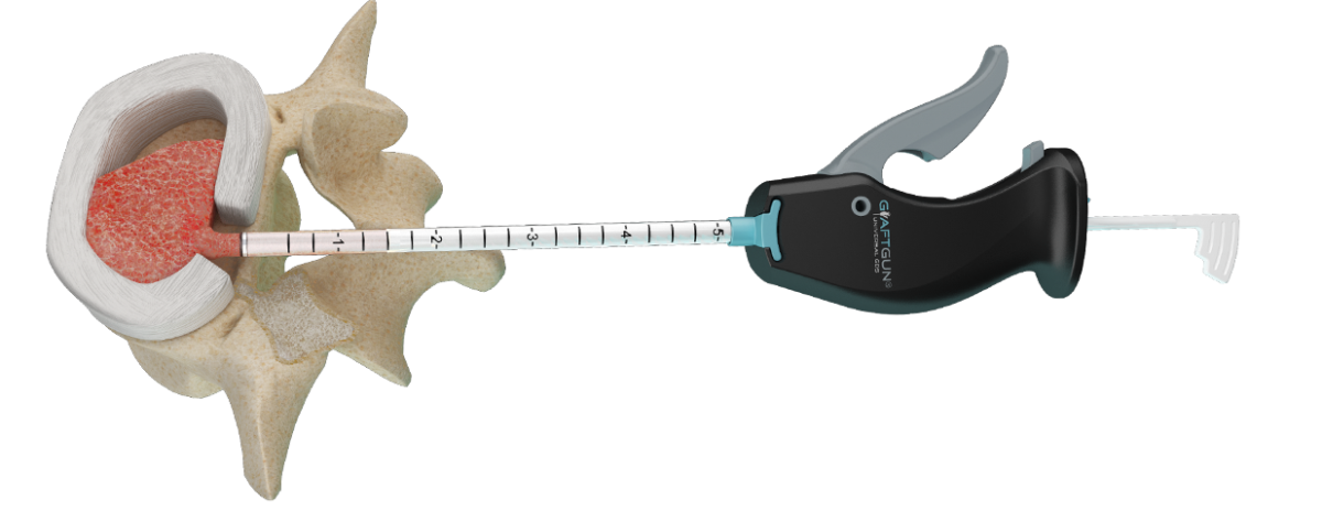 graftgun_zoom_v2-1-1200x464.png