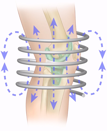 magnetic-fields-around-knee-1.jpg