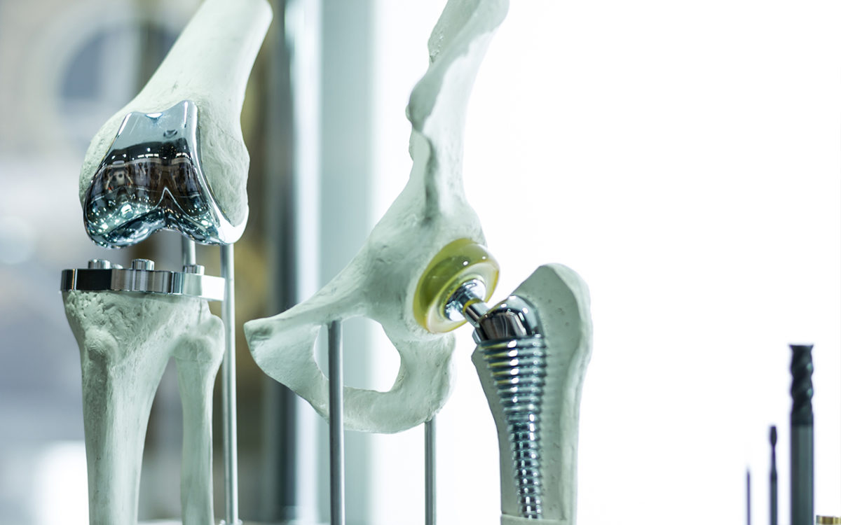 patella-ligament-1-1200x750.jpg
