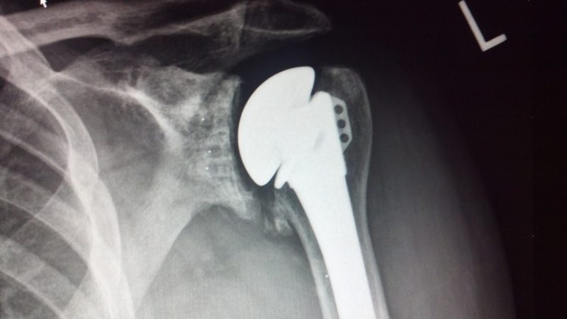 2012-02-15_15-17-38_225-e1509748037866-1.jpg