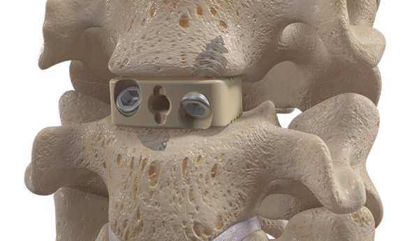 A_CIFT_SoloFuse_big-1-1-e1510937519460.png