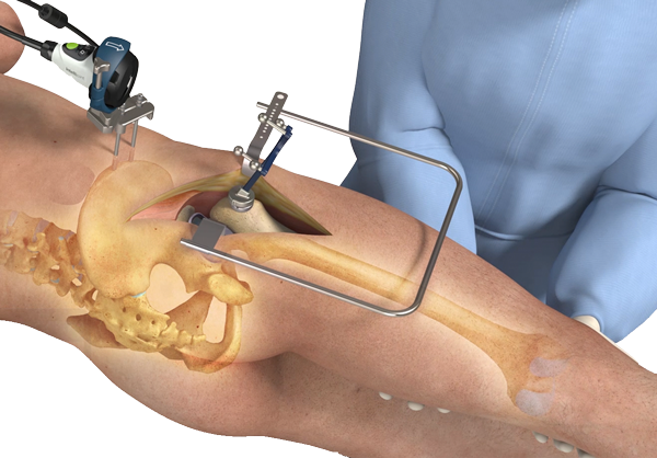 Surgery-Render.png