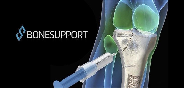 Trial_BonesupportCerament_WEB-1.jpg