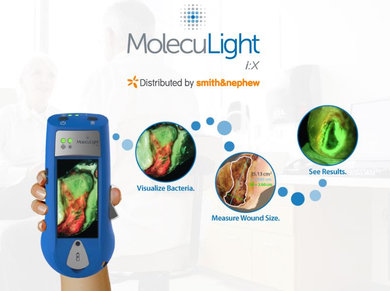 MolecuLight-2.jpg