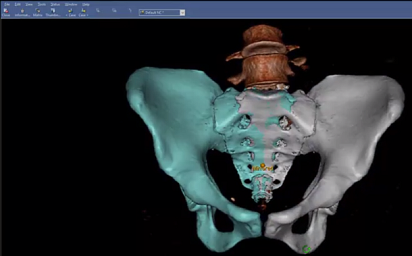 3dpelvictrauma-1024x576-1.png