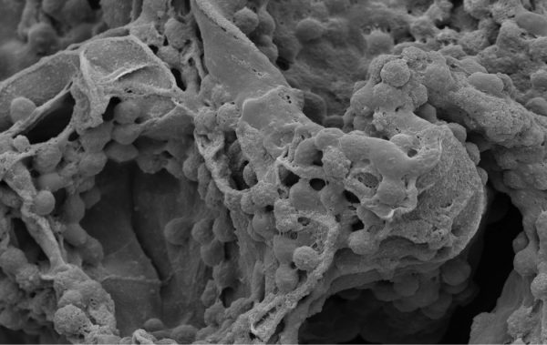 Bone-marrow-derived-stem-and-progenitor-cells-on-Osteo-P-TM-a-e1516207848914-1.jpg