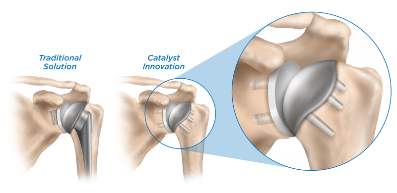 Catalyst_image_web2-e1516200878950-1.png