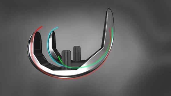 Implant-with-j-curves-2.jpg