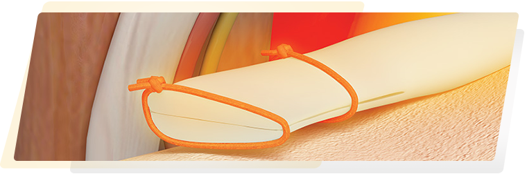 Physicians-WideImage-TheStitch-1.png