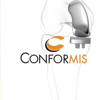 conformis-1-2.jpg