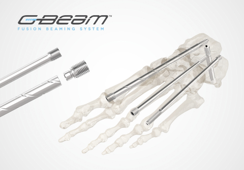 Orthofix_G-BEAM-1.jpg
