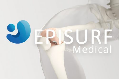 episurf-thumb2-e1519656183133-1.jpg