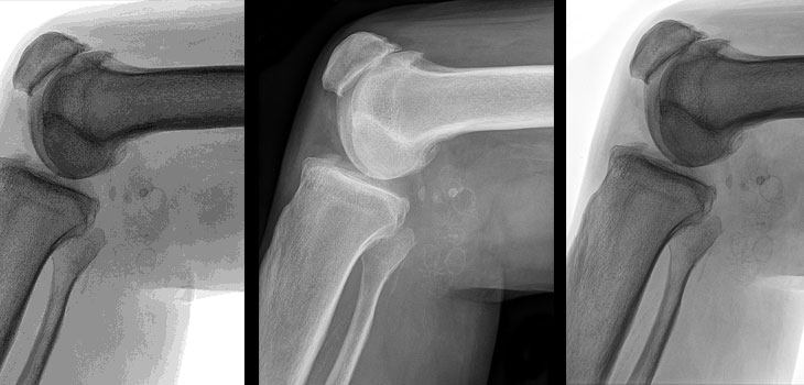 Firm_KneeOsteoarthritis_WEB-1.jpg