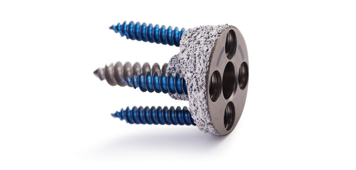 FirstCase_ComprehensiveAugmentedBaseplate_WEB-1.jpg