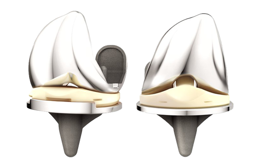 ATTUNE_Knee_System-1.png