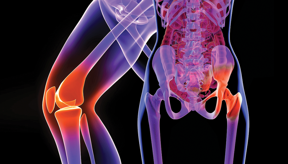 hip-and-knee-replacements-1.png
