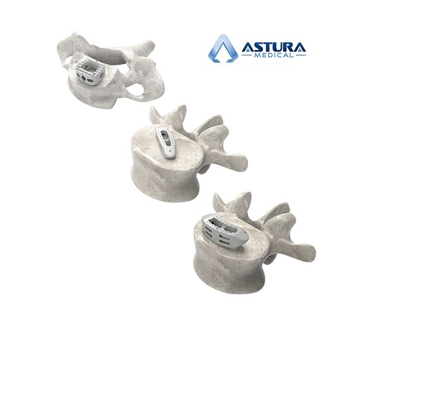 Astura-Med-002-12-2.jpg