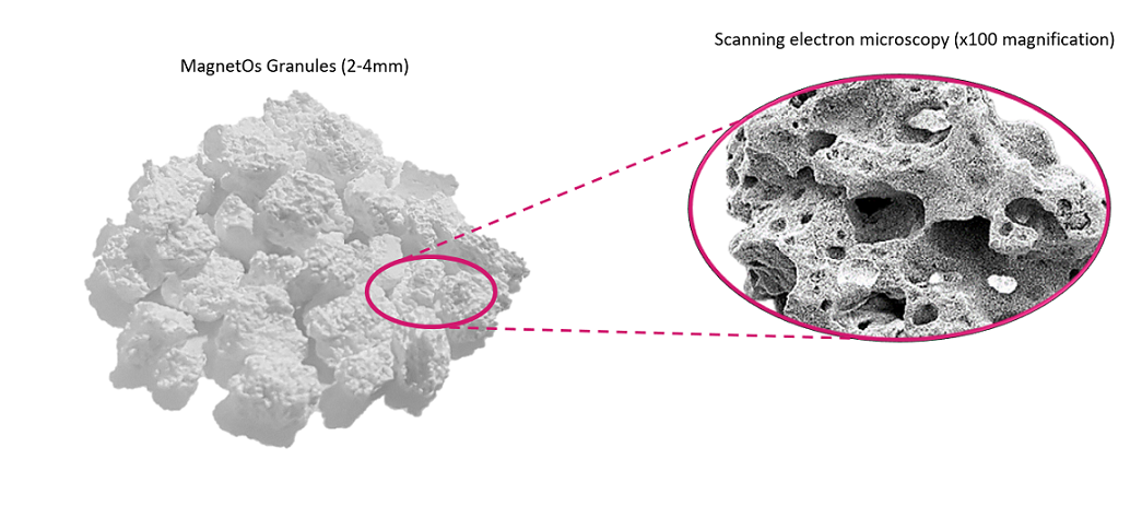 MagnetOs-Granules-Product-Shot-123.png