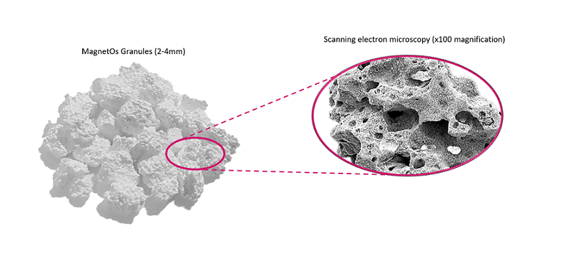 MagnetOs-Granules-Product-Shot-1-1.png