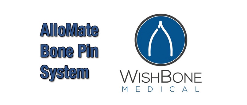 Wishbone-12bto-1.jpg