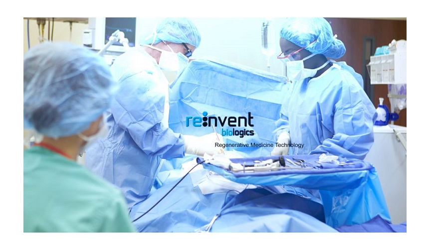 reinvent-screenshot-960x540-12bto.jpg