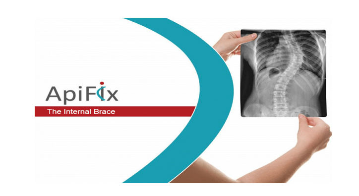 apifix-750x417-12bto-2.png