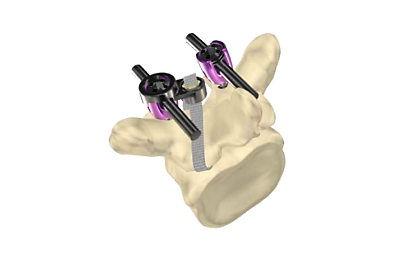 Jazz-Cap-System-300x240-1-12bto2-1.png